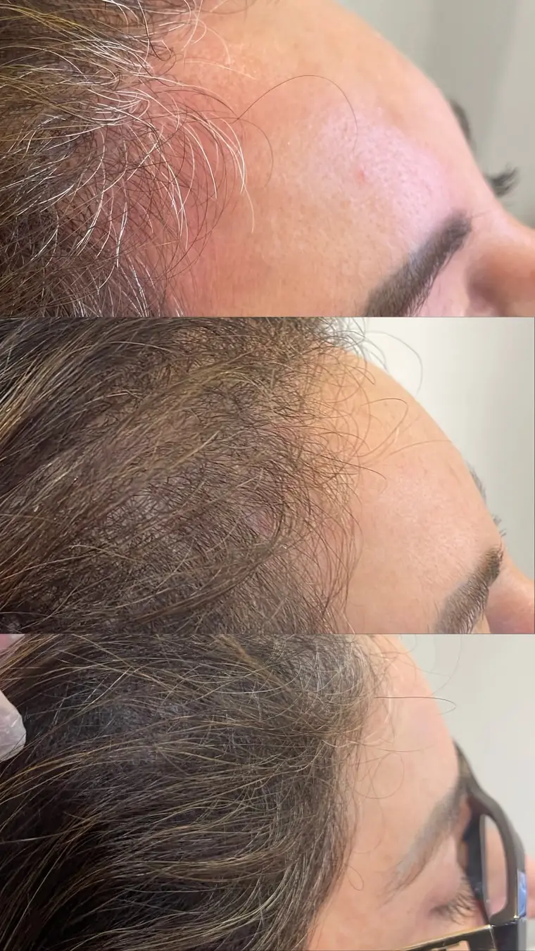 Aionê ExoHair